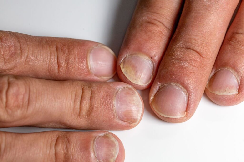 Comment empêcher le jaunissement des ongles ? - Marie Claire